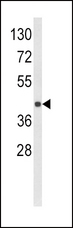 HLA-E Antibody - Western blot of HLA-E Antibody in MDA-MB231 cell line lysates (35 ug/lane). HLA-E (arrow) was detected using the purified antibody.