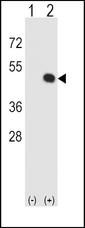HLA-E Antibody - Western blot of HLA-E (arrow) using rabbit polyclonal HLA-E Antibody. 293 cell lysates (2 ug/lane) either nontransfected (Lane 1) or transiently transfected (Lane 2) with the HLA-E gene.