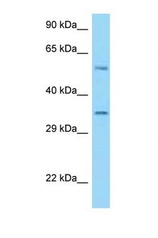 HLA-E Antibody - HLA-E antibody Western blot of U937 Cell lysate. Antibody concentration 1 ug/ml.  This image was taken for the unconjugated form of this product. Other forms have not been tested.