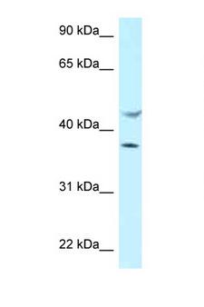 HLA-E Antibody - HLA-E antibody Western blot of MCF7 Cell lysate. Antibody concentration 1 ug/ml.  This image was taken for the unconjugated form of this product. Other forms have not been tested.