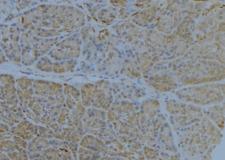 HLA-E Antibody - 1:100 staining human pancreas tissue by IHC-P. The sample was formaldehyde fixed and a heat mediated antigen retrieval step in citrate buffer was performed. The sample was then blocked and incubated with the antibody for 1.5 hours at 22°C. An HRP conjugated goat anti-rabbit antibody was used as the secondary.