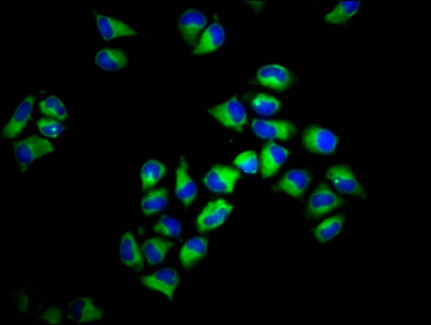 HLA-F Antibody - Immunofluorescence staining of Hela cells diluted at 1:133, counter-stained with DAPI. The cells were fixed in 4% formaldehyde, permeabilized using 0.2% Triton X-100 and blocked in 10% normal Goat Serum. The cells were then incubated with the antibody overnight at 4°C.The Secondary antibody was Alexa Fluor 488-congugated AffiniPure Goat Anti-Rabbit IgG (H+L).