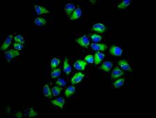 HLA-F Antibody - Immunofluorescence staining of Hela cells diluted at 1:133, counter-stained with DAPI. The cells were fixed in 4% formaldehyde, permeabilized using 0.2% Triton X-100 and blocked in 10% normal Goat Serum. The cells were then incubated with the antibody overnight at 4°C.The Secondary antibody was Alexa Fluor 488-congugated AffiniPure Goat Anti-Rabbit IgG (H+L).