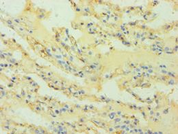 HLA-G Antibody - Immunohistochemistry of paraffin-embedded human lung using antibody at 1:100 dilution.