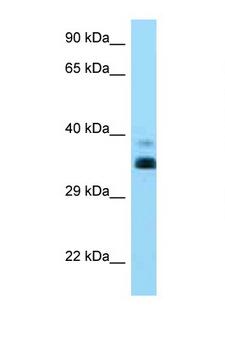 HLA-G Antibody - HLA-G antibody Western blot of 8226 Cell lysate. Antibody concentration 1 ug/ml.  This image was taken for the unconjugated form of this product. Other forms have not been tested.