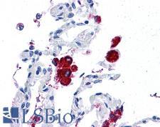 HLA-G Antibody - Human Lung: Formalin-Fixed, Paraffin-Embedded (FFPE)