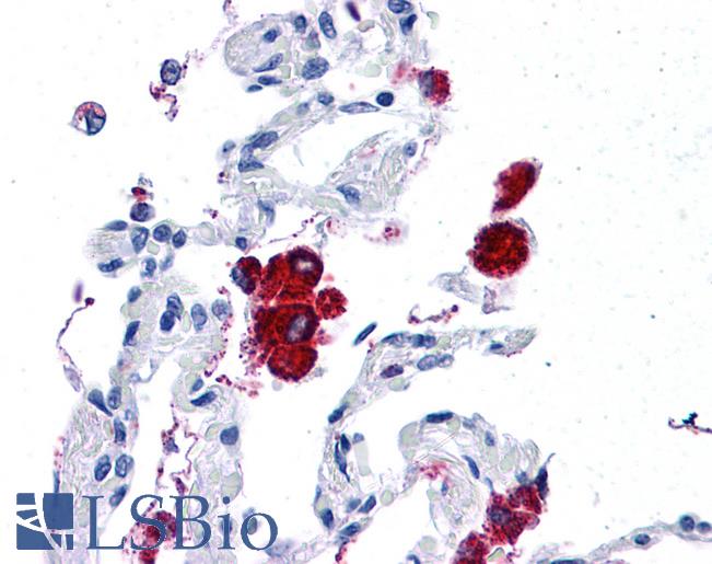 HLA-G Antibody - Human Lung: Formalin-Fixed, Paraffin-Embedded (FFPE)