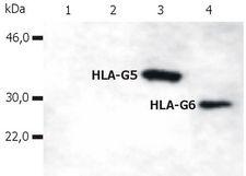 HLA-G Antibody - HLA-G (soluble) Antibody in Western Blot (WB)