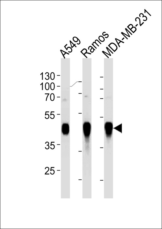 HLA-G Antibody - HLA-G Antibody western blot of A549,Ramos,MDA-MB-231 cell line lysates (35 ug/lane). The HLA-G antibody detected the HLA-G protein (arrow).
