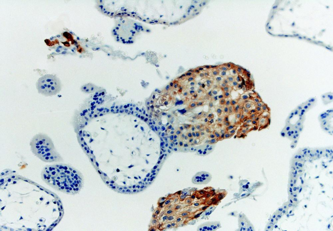 HLA-G Antibody - Immunohistochemistry staining with anti-human HLA-G (MEM-G/1) of first trimester placenta (paraffin-embedded sections).