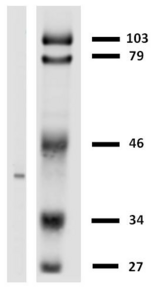 HLA-G Antibody - Western blotting analysis of HLA-G in LCL-HLA-G transfectants using anti-HLA-G (MEM-G/2).