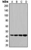 HLA-G Antibody - Western blot analysis of HLA-G expression in JEG3 (A); HeLa (B); Raw264.7 (C); PC12 (D) whole cell lysates.