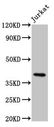 HLA-G Antibody - Western Blot Positive WB detected in: Jurkat whole cell lysate All lanes: HLA-G antibody at 8µg/ml Secondary Goat polyclonal to rabbit IgG at 1/50000 dilution Predicted band size: 39 kDa Observed band size: 39 kDa