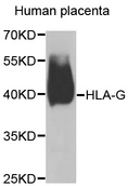 HLA-G Antibody - Western blot analysis of extracts of human placenta.