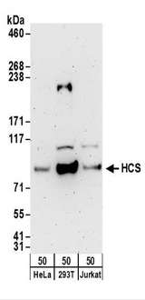 HLCS / HCS Antibody - Detection of Human HCS by Western Blot. Samples: Whole cell lysate (50 ug) from HeLa, 293T, and Jurkat cells. Antibodies: Affinity purified rabbit anti-HCS antibody used for WB at 0.4 ug/ml. Detection: Chemiluminescence with an exposure time of 3 minutes.