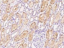 HLCS / HCS Antibody - Immunochemical staining of human HLCS in human kidney with rabbit polyclonal antibody at 1:300 dilution, formalin-fixed paraffin embedded sections.