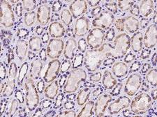 HLCS / HCS Antibody - Immunochemical staining of human HLCS in human kidney with rabbit polyclonal antibody at 1:100 dilution, formalin-fixed paraffin embedded sections.
