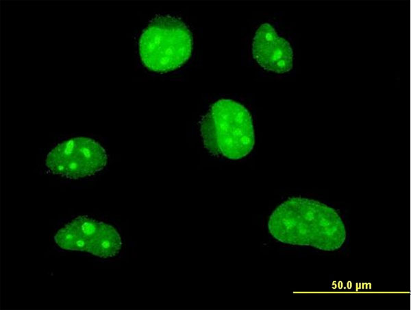 HLF Antibody - Immunofluorescence of monoclonal antibody to HLF on HeLa cell . [antibody concentration 10 ug/ml]