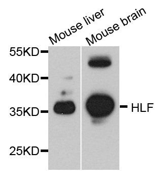 HLF Antibody - Western blot analysis of extract of various cells.