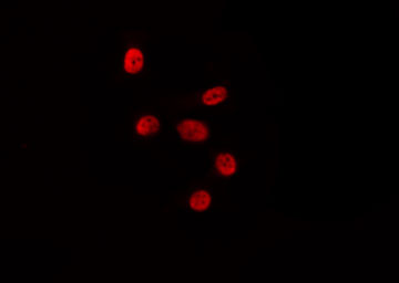 HLF Antibody - Staining HepG2 cells by IF/ICC. The samples were fixed with PFA and permeabilized in 0.1% Triton X-100, then blocked in 10% serum for 45 min at 25°C. The primary antibody was diluted at 1:200 and incubated with the sample for 1 hour at 37°C. An Alexa Fluor 594 conjugated goat anti-rabbit IgG (H+L) Ab, diluted at 1/600, was used as the secondary antibody.