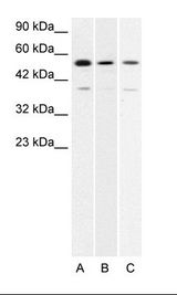 HLX1 / HLX Antibody - A. Jurkat Cell Lysate B. HepG2 Cell Lysate.  This image was taken for the unconjugated form of this product. Other forms have not been tested.