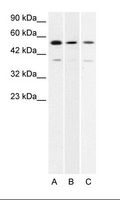 HLX1 / HLX Antibody - A. Jurkat Cell Lysate B. HepG2 Cell Lysate.  This image was taken for the unconjugated form of this product. Other forms have not been tested.