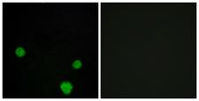 HLX1 / HLX Antibody - Immunofluorescence analysis of MCF7 cells, using HLX1 Antibody. The picture on the right is blocked with the synthesized peptide.