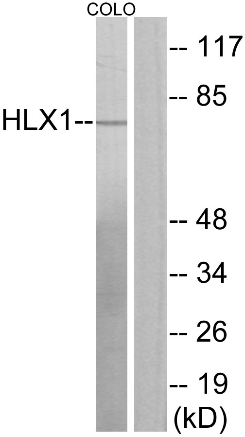 HLX1 / HLX Antibody - Western blot analysis of lysates from COLO205 cells, using HLX1 Antibody. The lane on the right is blocked with the synthesized peptide.