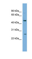 HLX1 / HLX Antibody - HLX / HLX1 antibody Western blot of PANC1 cell lysate. This image was taken for the unconjugated form of this product. Other forms have not been tested.