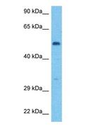 HLX1 / HLX Antibody - Western blot of HLX Antibody with human 721_B Whole Cell lysate.  This image was taken for the unconjugated form of this product. Other forms have not been tested.