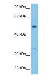 HLX1 / HLX Antibody - Western blot of HLX Antibody with human 721_B Whole Cell lysate.  This image was taken for the unconjugated form of this product. Other forms have not been tested.
