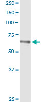 HLX1 / HLX Antibody - Immunoprecipitation of HLX transfected lysate using anti-HLX monoclonal antibody and Protein A Magnetic Bead, and immunoblotted with HLX rabbit polyclonal antibody.