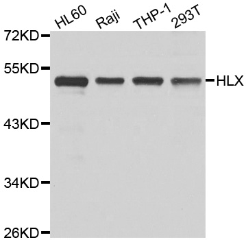 HLX1 / HLX Antibody - Western blot analysis of extracts of various cell lines.