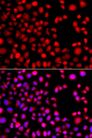 HLX1 / HLX Antibody - Immunofluorescence analysis of A549 cells using HLX antibody. Blue: DAPI for nuclear staining.