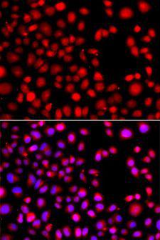 HLX1 / HLX Antibody - Immunofluorescence analysis of A549 cells using HLX antibody. Blue: DAPI for nuclear staining.