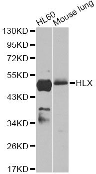 HLX1 / HLX Antibody - Western blot analysis of extracts of various cell lines, using HLX antibody at 1:1000 dilution. The secondary antibody used was an HRP Goat Anti-Rabbit IgG (H+L) at 1:10000 dilution. Lysates were loaded 25ug per lane and 3% nonfat dry milk in TBST was used for blocking. An ECL Kit was used for detection and the exposure time was 30s.