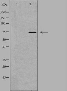 HLX1 / HLX Antibody - Western blot analysis of extracts of COLO205 cells using HLX1 antibody. The lane on the left is treated with the antigen-specific peptide.