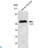 HLX1 / HLX Antibody - Western Blot (WB) analysis using HLX1 Monoclonal Antibody against Mouse pancreas cell lysate.