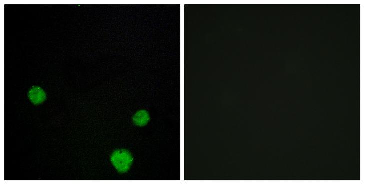 HLX1 / HLX Antibody - Peptide - + Immunofluorescence analysis of MCF-7 cells, using HLX1 antibody.