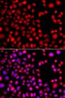 HLX1 / HLX Antibody - Immunofluorescence analysis of A549 cells using HLX Polyclonal Antibody.