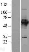 HLX1 / HLX Protein - Western validation with an anti-DDK antibody * L: Control HEK293 lysate R: Over-expression lysate