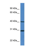HM13 / IMP-1 / SPP Antibody - HM13 antibody Western blot of Mouse Spleen lysate. Antibody concentration 1 ug/ml. This image was taken for the unconjugated form of this product. Other forms have not been tested.