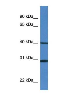 HM13 / IMP-1 / SPP Antibody - HM13 antibody Western blot of Mouse Spleen lysate. Antibody concentration 1 ug/ml. This image was taken for the unconjugated form of this product. Other forms have not been tested.