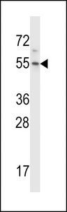 HM13 / IMP-1 / SPP Antibody - HM13 Antibody western blot of HeLa cell line lysates (35 ug/lane). The HM13 antibody detected the HM13 protein (arrow).