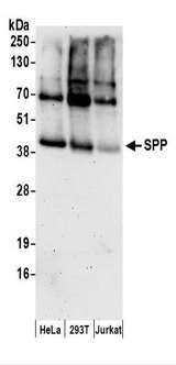 HM13 / IMP-1 / SPP Antibody - Detection of Human SPP by Western Blot. Samples: Whole cell lysate (50 ug) prepared using NETN buffer from HeLa, 293T, and Jurkat cells. Antibodies: Affinity purified rabbit anti-SPP antibody used for WB at 0.1 ug/ml. Detection: Chemiluminescence with an exposure time of 3 minutes.