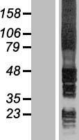 HM13 / IMP-1 / SPP Protein - Western validation with an anti-DDK antibody * L: Control HEK293 lysate R: Over-expression lysate
