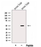 HMBOX1 Antibody - Western blot analysis of extracts of mouse brain tissue using HMBOX1 antibody. The lane on the left was treated with blocking peptide.