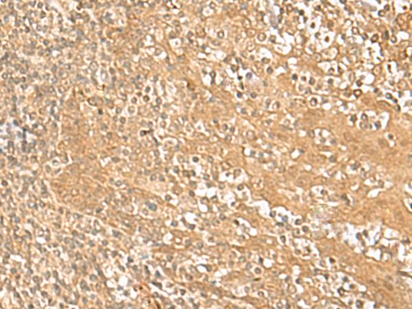 HMBOX1 Antibody - Immunohistochemistry of paraffin-embedded Human tonsil tissue  using HMBOX1 Polyclonal Antibody at dilution of 1:30(×200)