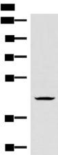 HMBOX1 Antibody - Western blot analysis of Jurkat cell lysate  using HMBOX1 Polyclonal Antibody at dilution of 1:300
