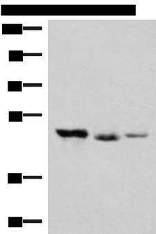 HMBOX1 Antibody - Western blot analysis of K562 and Jurkat cell Mouse kidney tissue lysates  using HMBOX1 Polyclonal Antibody at dilution of 1:500
